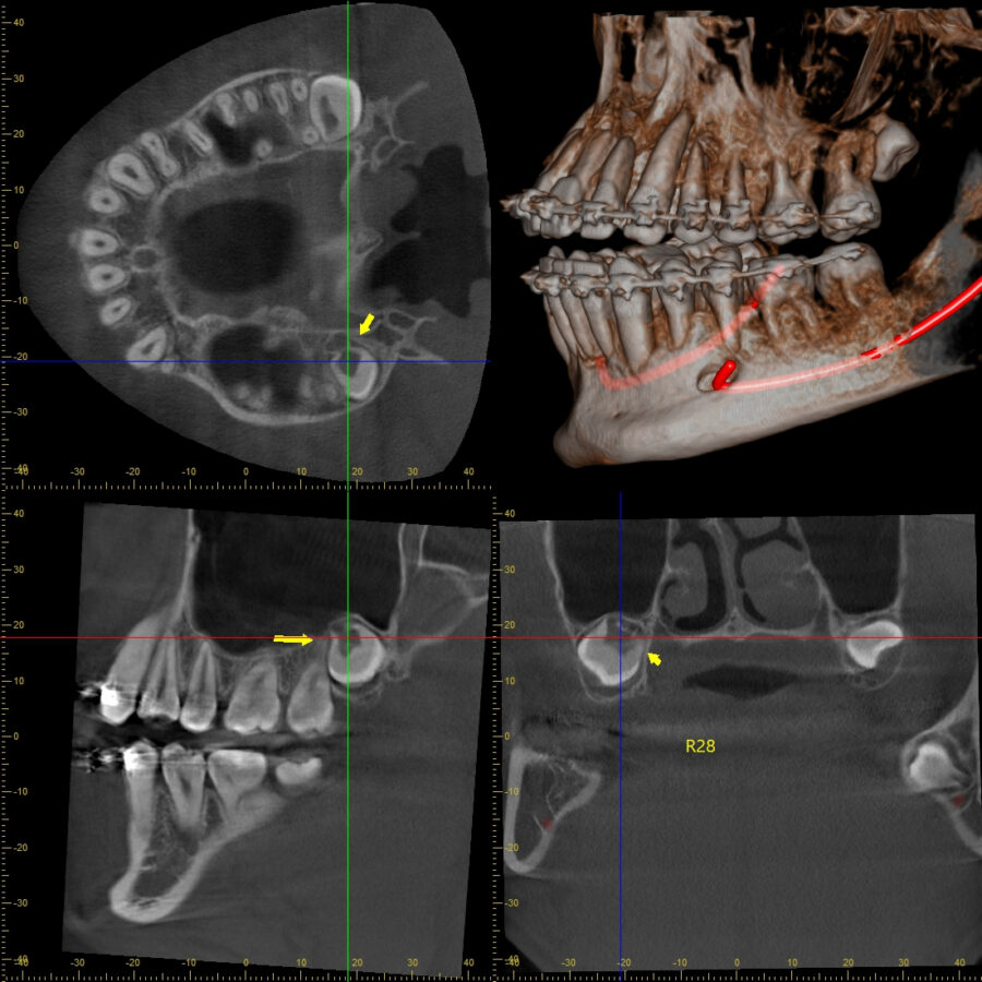 X-quang CBCT và bài toán tối ưu hóa chi phí, lợi nhuận đầu tư cho phòng khám nha khoa