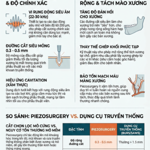 Nong rộng và tách mào xương