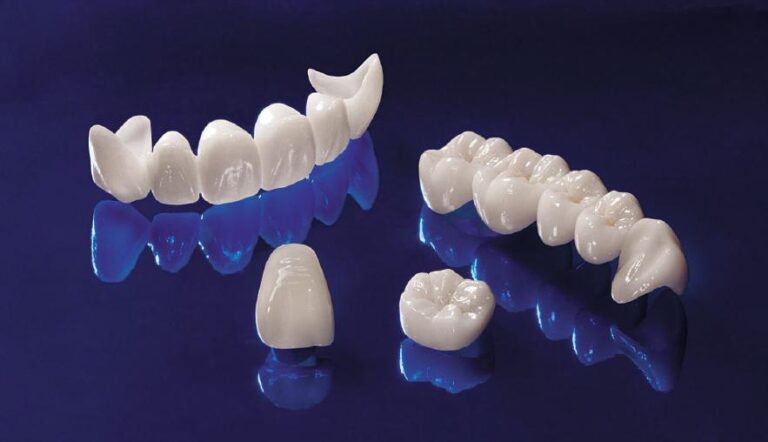 Phục hình toàn sứ Zirconia và Emax: Bác sĩ nên chọn loại nào?