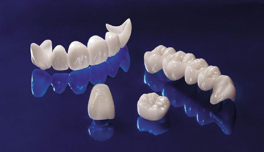 Phục hình toàn sứ Zirconia và Emax: Bác sĩ nên chọn loại nào?