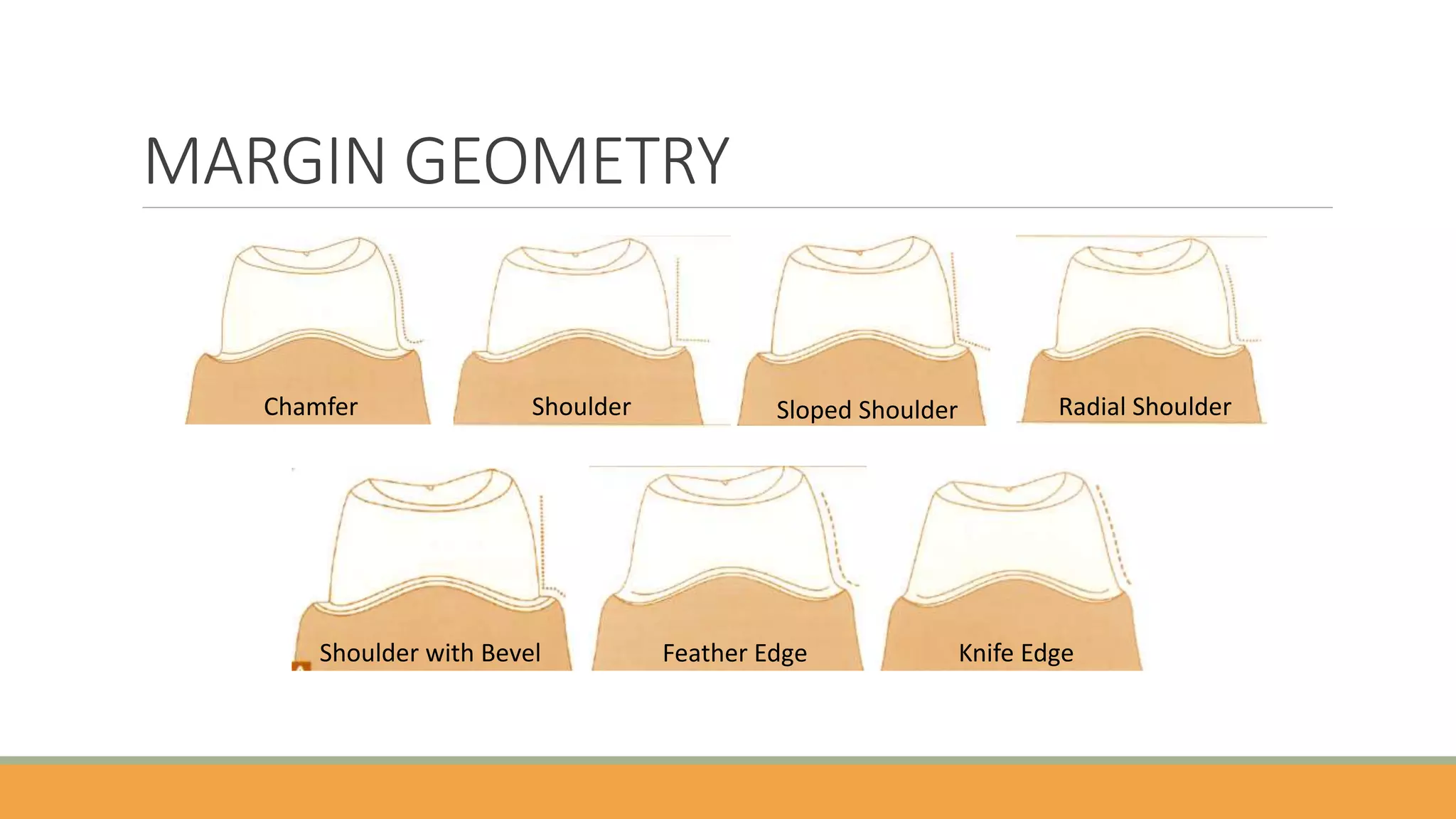 Hình vẽ kỹ thuật so sánh 5 dạng đường hoàn tất trong mài cùi răng gồm Knife Edge, Chamfer, Shoulder, Shoulder Bevel và Deep Chamfer, thể hiện rõ hình dạng góc mài và độ dày vật liệu cần thiết cho từng loại phục hình như mão kim loại, sứ kim loại (PFM) và toàn sứ.