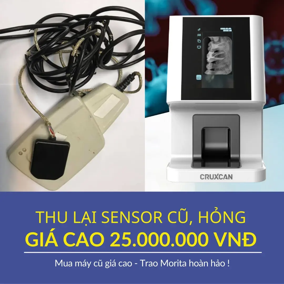 thu cu scan